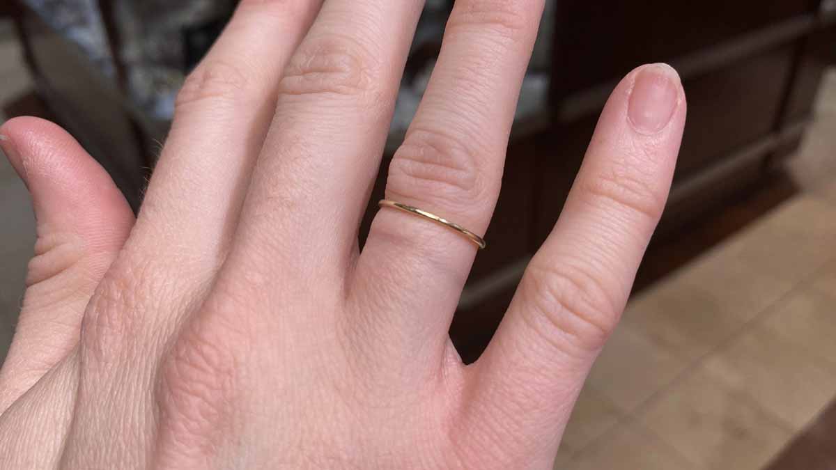 What Makes Jewelry Leave Green Marks on Your Skin? Causes, Metals, and Prevention